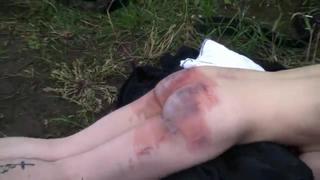 Very Harsh Real Flogging Of The Swedish Slave In The Forest 