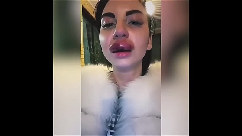 Губы накачала