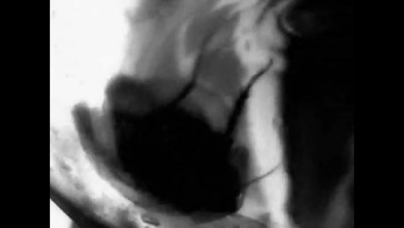 Жуки в пизде ужасные пытки