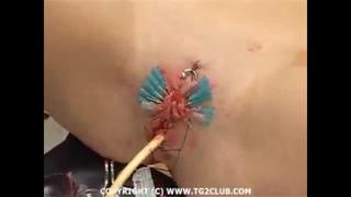 The Girl Was Sewn Up And Inserted A Tube To Write A Tin Of The Vagina Private Homemade Amateur Russian Porn Sex 