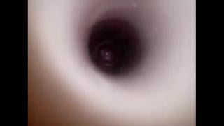 Camera inside the anus during anal sex 
